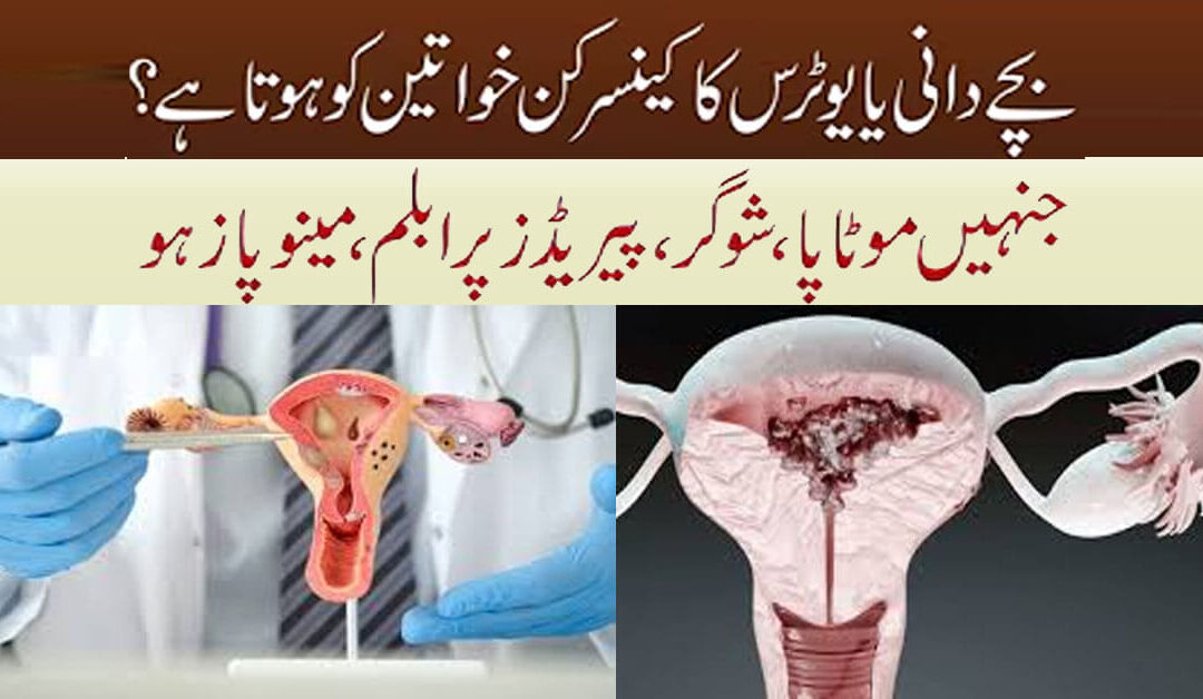 Uterine Cancer Symptoms Treatment