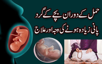 Hamal Mein Pani Zyada Hone Ki Waja Or Ilaj