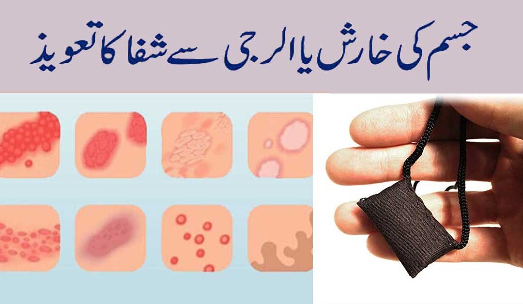 Surah For Skin Allergy