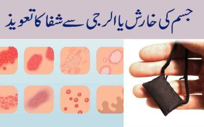 Jism Ki Kharish Aur Allergy Se Shifa Ka Taweez