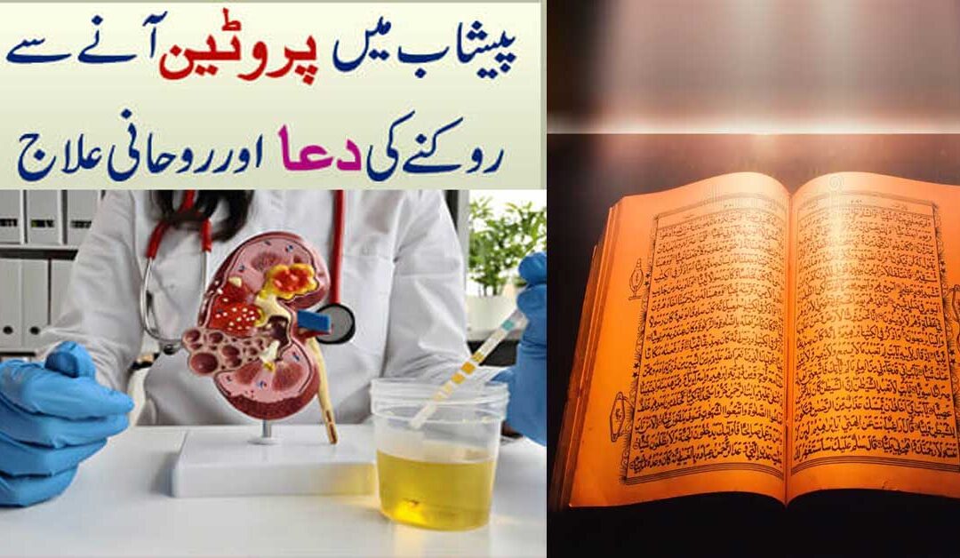 Protein In Urine Treatment In Quran