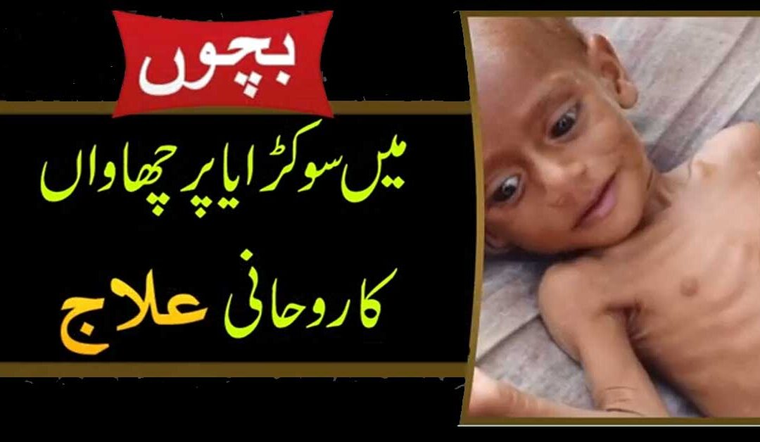 Sokra ka Ilaj