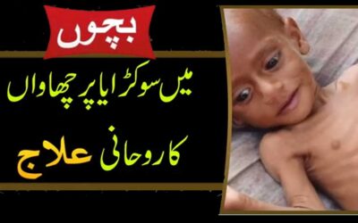 Bachon Mein Sokry Ka Rohani Ilaj
