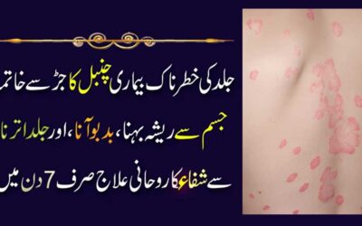 Chambal Ki Bimari Se Shifa Ka Rohani Ilaj