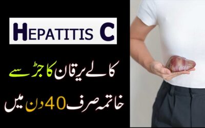 Kala Yarkan Khatam Karne Ka Rohani Ilaj