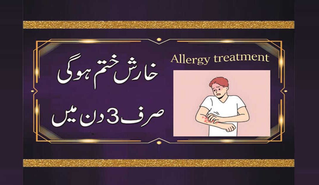 Kharish Khatam Karne Ka Wazifa