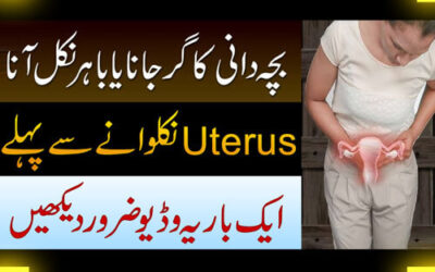 Uterus/Reham Ke Girne Ka Ilaj