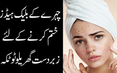 Chehre Ke Blackheads Khatam Karne Ka Totka