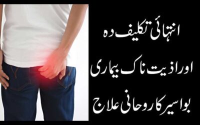 Bawaseer Se Shifa Ka Rohani Ilaj