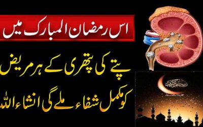 Naqsh For Kidney Stone In Ramzan