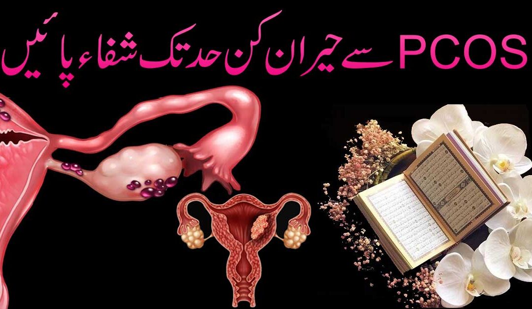PCOS Se shifa Ka Rohani Ilaj