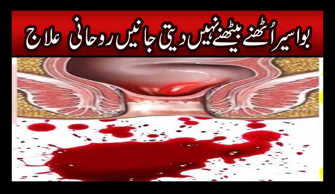 Bawaseer Se Fori Shifa Ka Rohani Ilaj