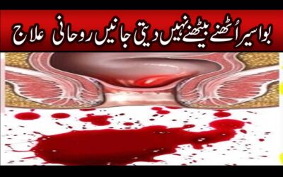 Bawaseer Se Fori Shifa Ka Rohani Ilaj
