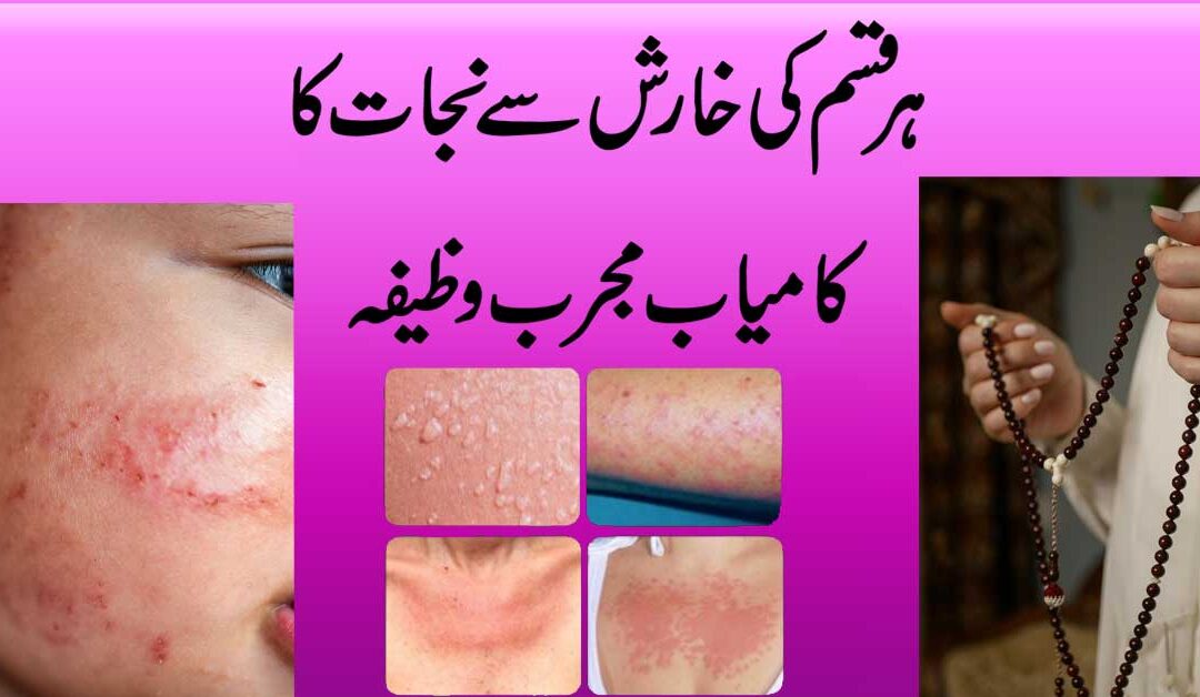Har Qism Ki Kharish Se Nijat Ka Wazifa