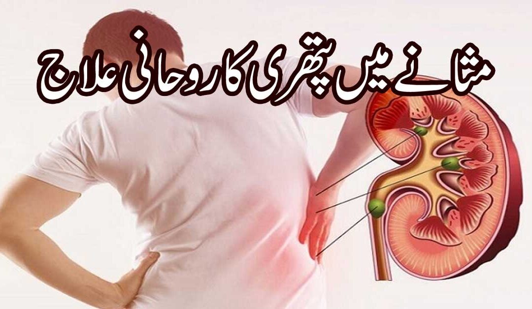 Masana Ki Pathri Ka Ilaj