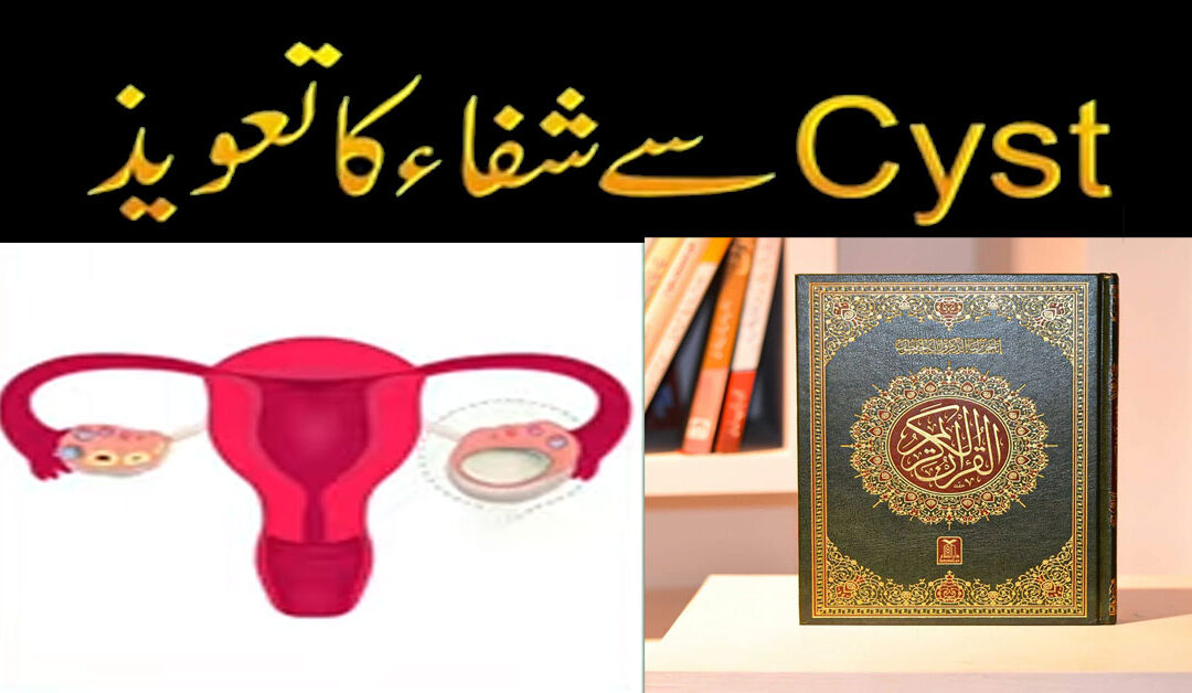Cyst Se Shifa ka Taweez
