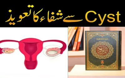 Cyst Se Shifa ka Taweez | Anda Dani Ki Rasoli Ka Ilaj