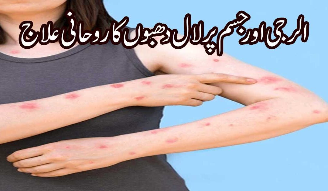 Allergy Aur Infection Se Shifa Ka Taweez