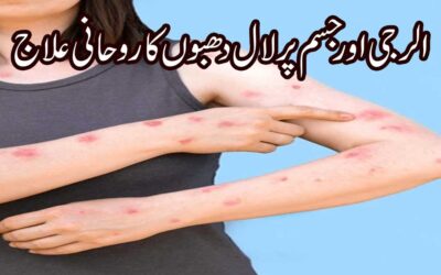 Allergy Aur Infection Se Shifa Ka Taweez