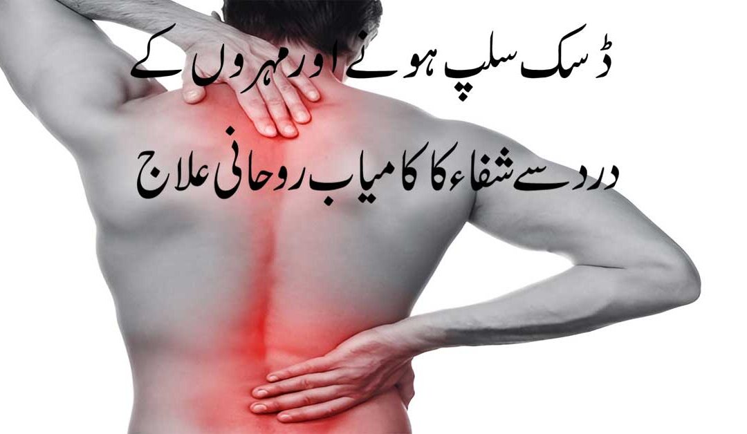 Slipped Disc: Symptoms, Causes,