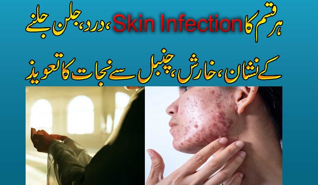 Har Qism Ke Skin Infection Se Nijat Ka Taweez