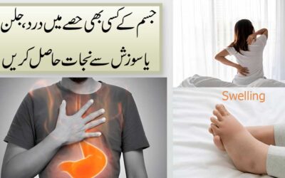 Jism K Kisi Bhi Hissay Me Sozish Ka Ilaj
