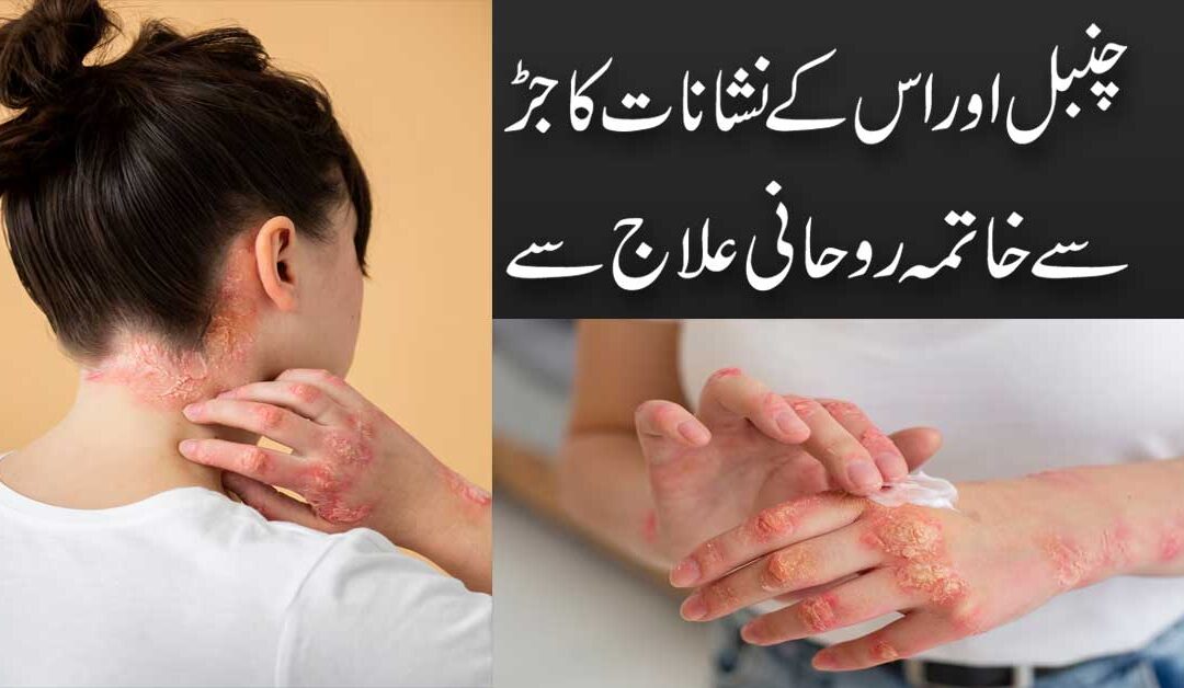 Chambal Ki Bimari Se Shifa Ka Taweez
