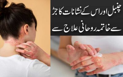 Chambal Ki Bimari Se Shifa Ka Taweez