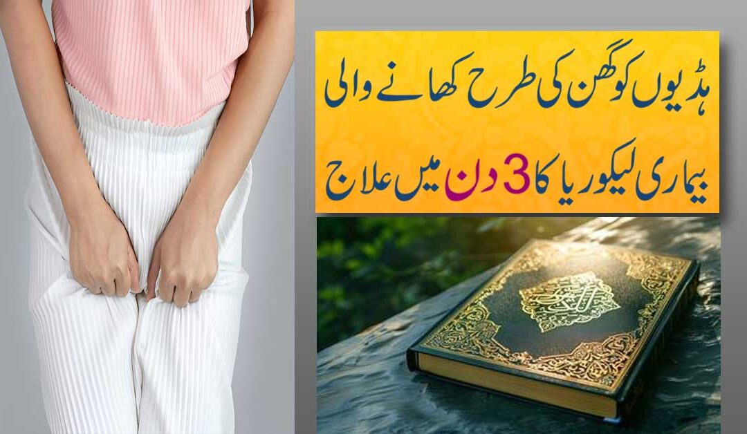 Likoria Ki Bimari Se Nijat Ka Ilaj