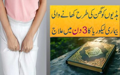 The Best Rohani Treatment For White Distarge