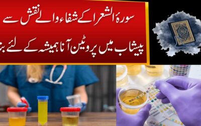Peshab Mein Protein Se Shifa Ka Naqsh