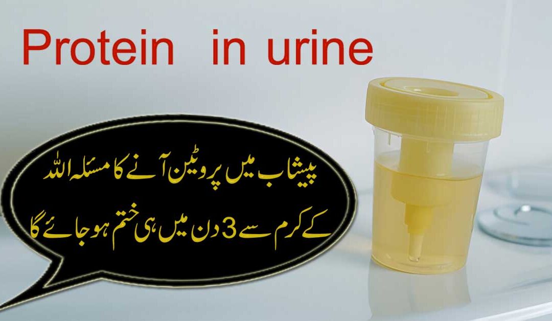 Peshab Mein Protein Aana Dino Mai Khatam