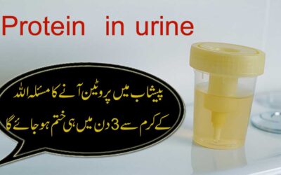 Protein In Urine Treatment