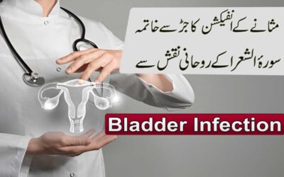 Bladder Infection Treatment