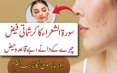 Naqsh For Face Pimples Remove