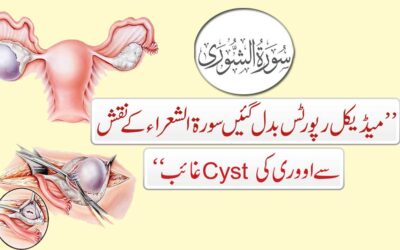Cyst Se Shifa Ka Rohani Naqsh