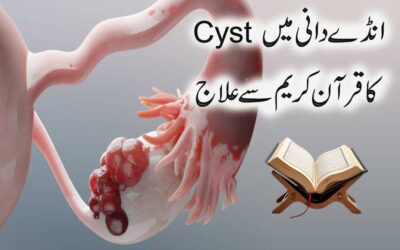 Cyst Ka Ilaj Surah Shuara Se