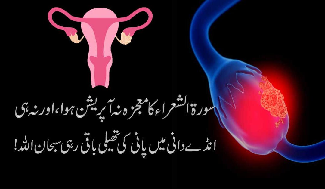 Andedani Mein Pani Ki Tehli Se Shifa Ka Taweez