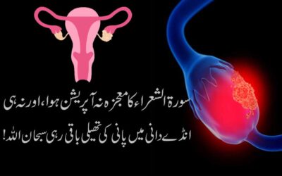 Ovarian Cyst Ka Rohani Taweez